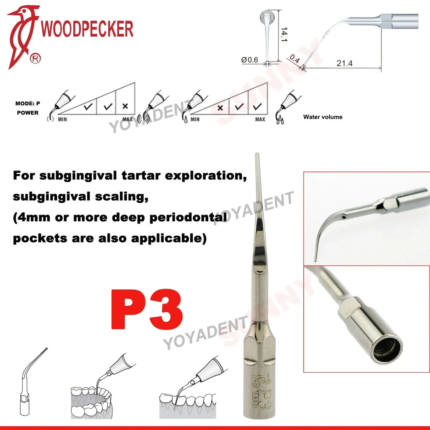 Dentistry Supplies & Equipment Woodpecker DTE Ultrasonic Piezo Scaler P3