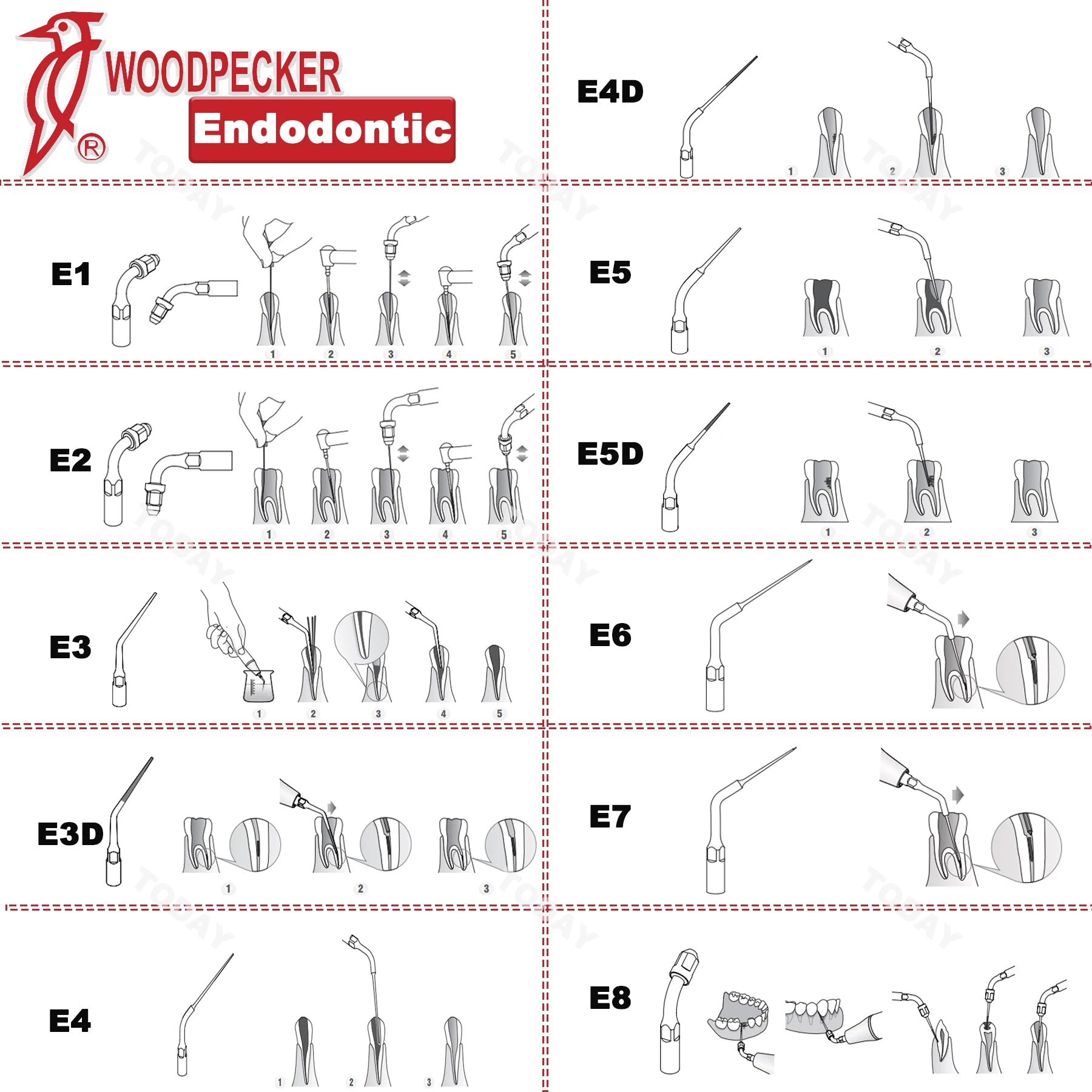 Dentistry Supplies & Equipment Woodpecker DTE Ultrasonic Scaler -  all available DTE Tips E series  shown on the picture
