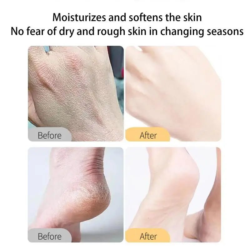 Personal Health Care Advanced anti-dry Repair Cream for Dry and Cracked Skin Relief