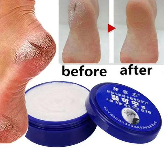 personal-health-care-anti-crack-cream-product-foot-before-and-after-use-picture