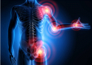 Personal Health Care, diagram of areas of the human body susceptible to rheumatism, Blog: Reduce Rheumatic Pain