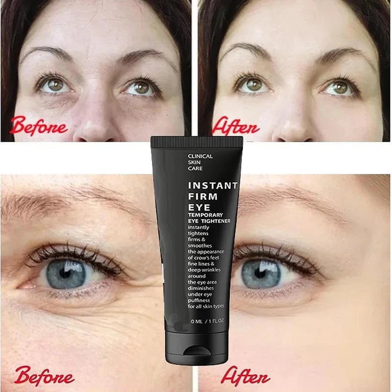 Personal health care eye cream wrinkle removal instant before and after use around eye treatment picture