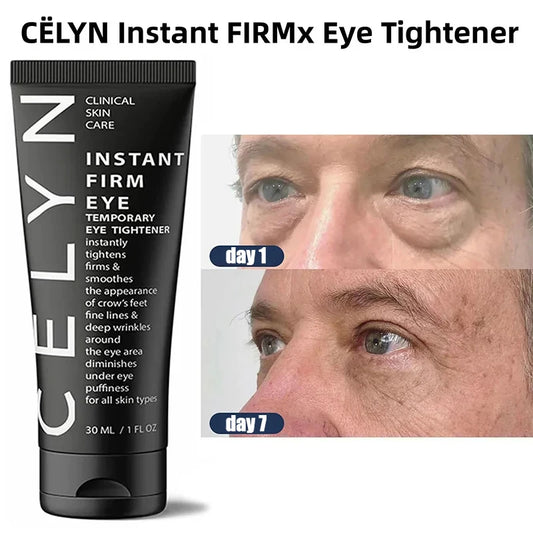 Personal health care eye cream wrinkle removal instant