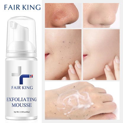 personal-health-care-facial-exfoliating-peeling-gel-cream-remove-nose-or-face-or-hand-dark-spots-picture