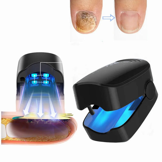 personal-health-care-nail-fungus-device-blue-colour-laser-show-picture