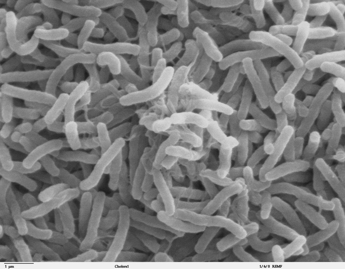 Personal Health Care, Picture of cholera Bacteria, Blog: Can Cholera be prevented?