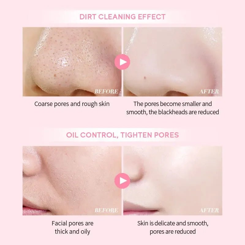 Personal Health Care Pink Mud Mask Deep Cleansing - Laikou Sakura - Balance Oil Control