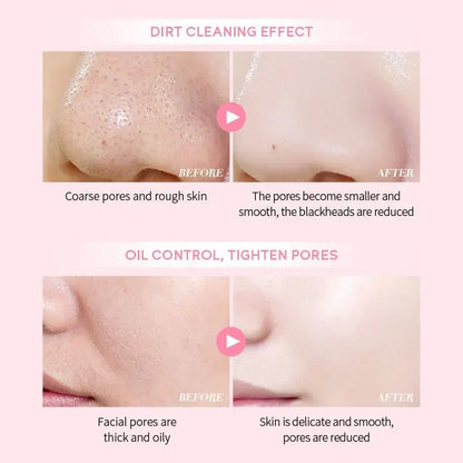 Personal Health Care Pink Mud Mask Deep Cleansing - Laikou Sakura - Balance Oil Control