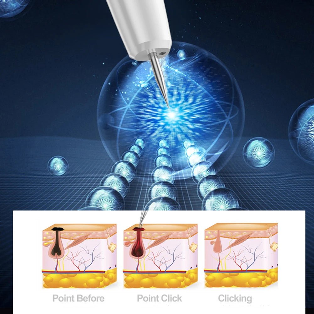 Personal Health Care Plasma Pen Skin Tag Remover Freckle (15 Level)