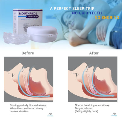 Personal Health Care Silicone Anti-Snoring Bruxism Mouth Guard Working process