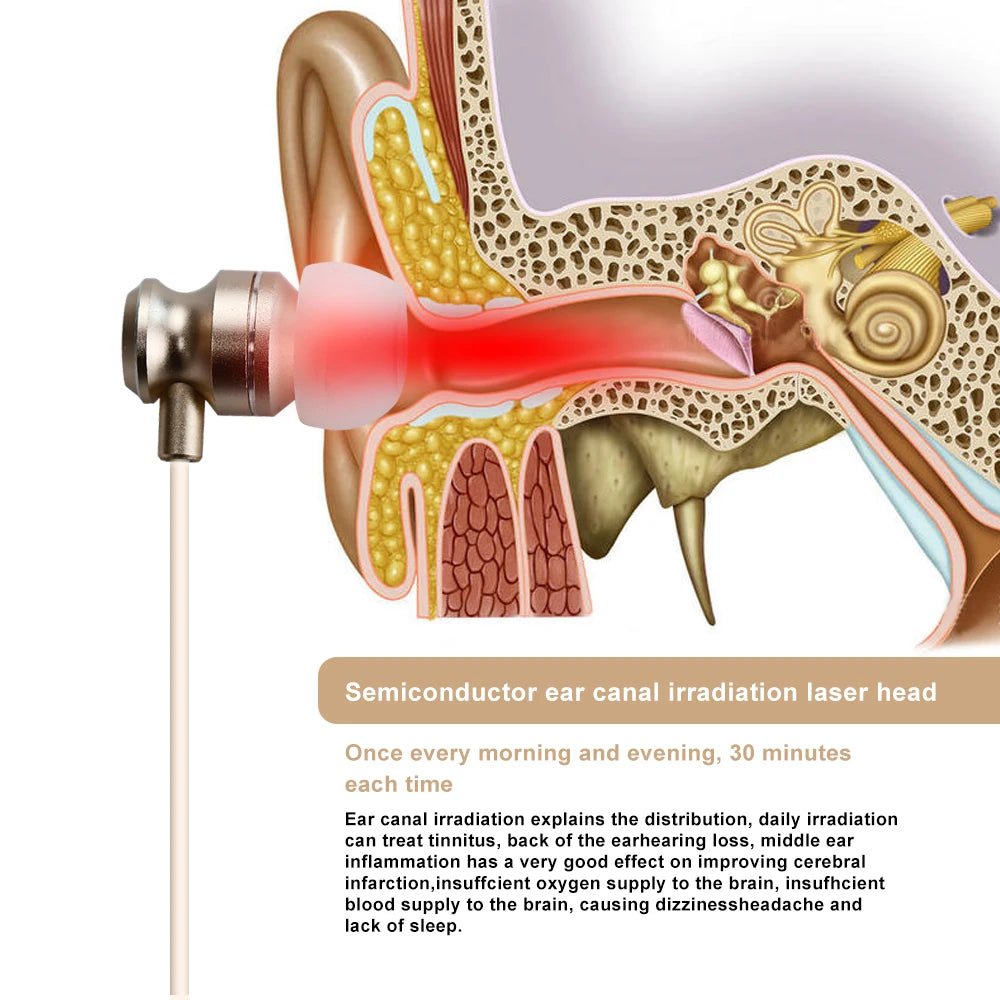 Personal Health care Tinnitus Relief Earplugs Red Light Irradiator 650nm Anatomy of internal ear