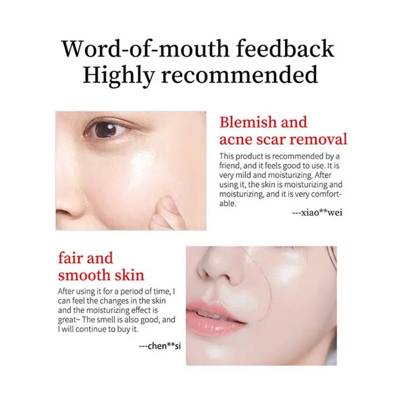 Personal Health Care Whitening Face and Remove Freckle Cream 
