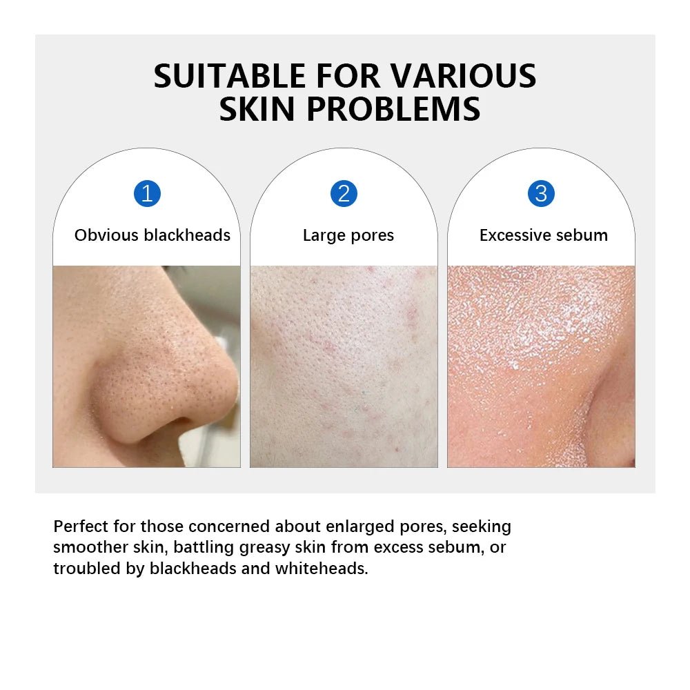 Personal Health Care Zero Pore Pad Double Textured Facial Toner For Exfoliating and Smoothing - Korean Skin Care Treatment (70 Pieces)