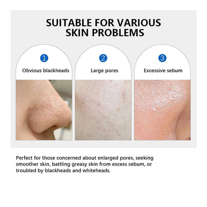 Personal Health Care Zero Pore Pad Double Textured Facial Toner For Exfoliating and Smoothing - Korean Skin Care Treatment (70 Pieces)