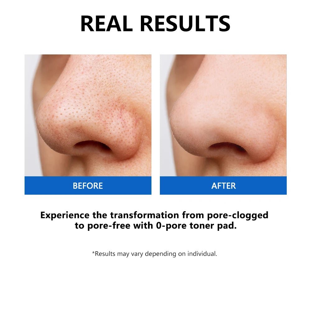 Personal Health Care Zero Pore Toner Pads Control Oil, Reduce Sebum - Deep Clean - Korean Skincare Treatment