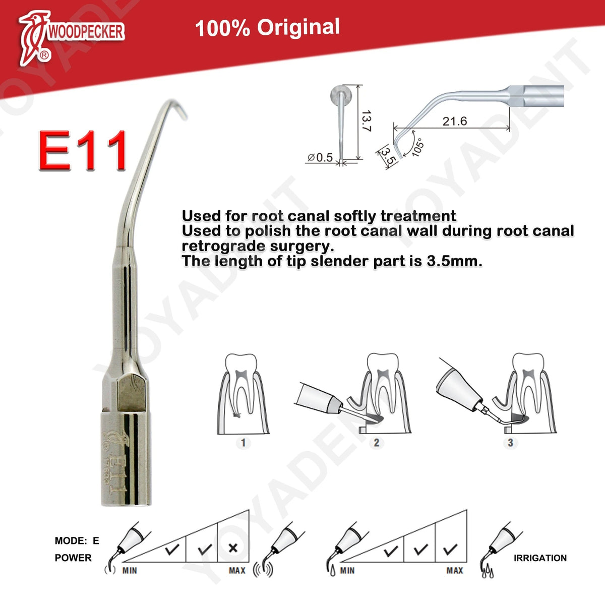Woodpecker DTE Ultrasonic Scaler Tips