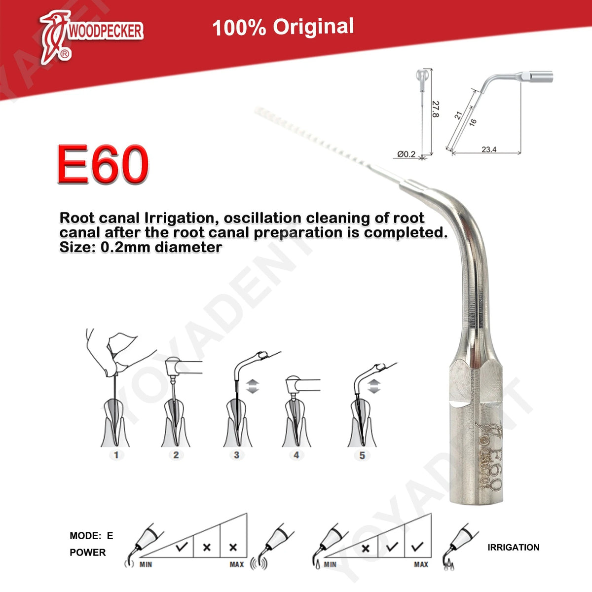 Woodpecker DTE Ultrasonic Scaler Tips