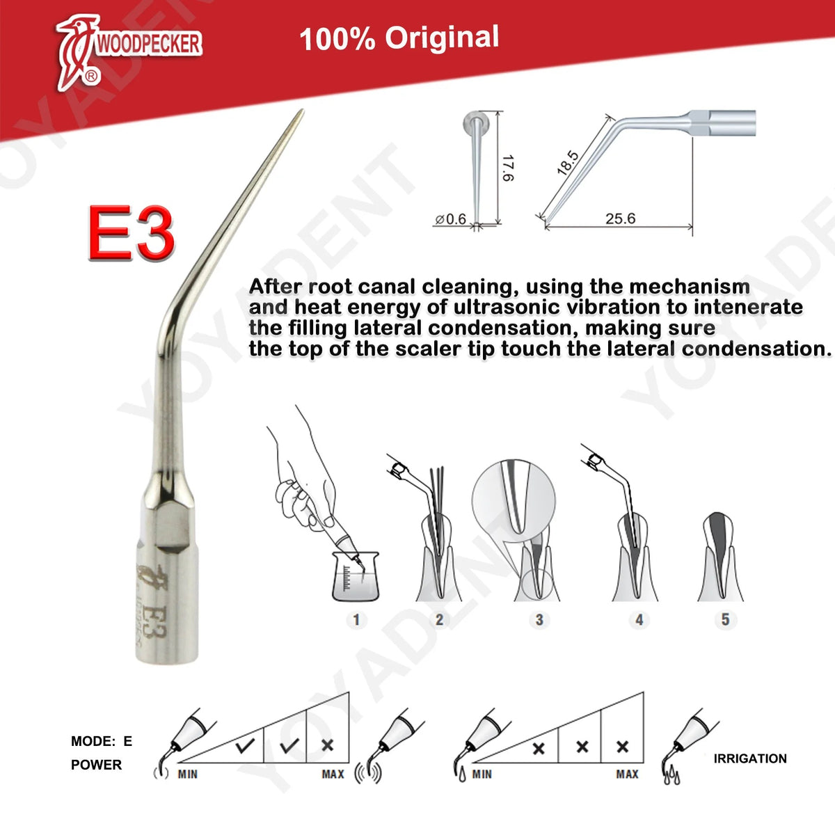 Woodpecker DTE Ultrasonic Scaler Tips