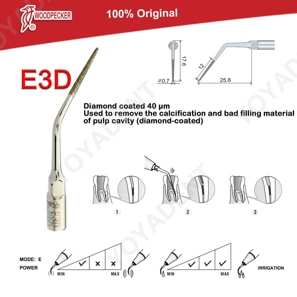 Woodpecker DTE Ultrasonic Scaler Tips