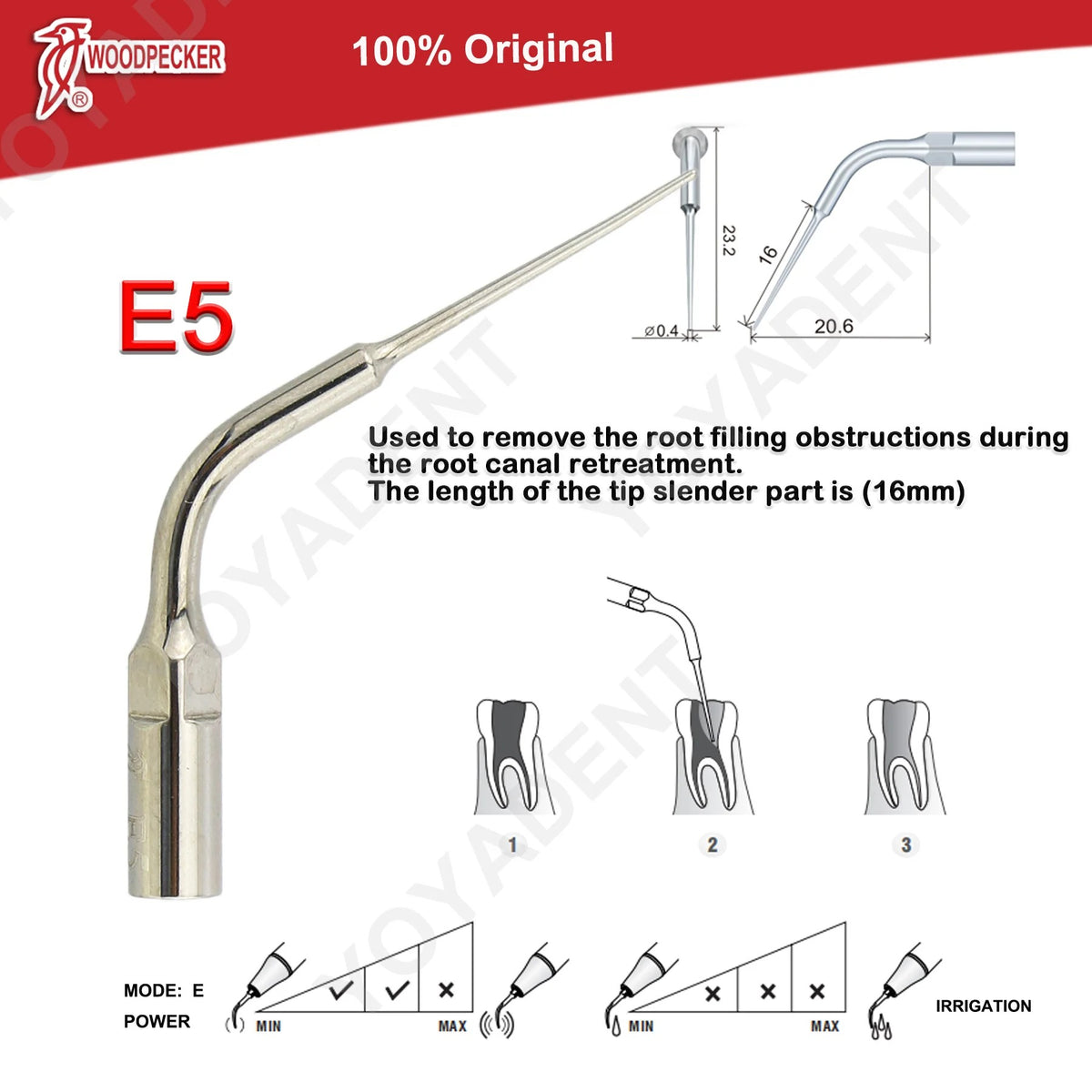 Woodpecker DTE Ultrasonic Scaler Tips