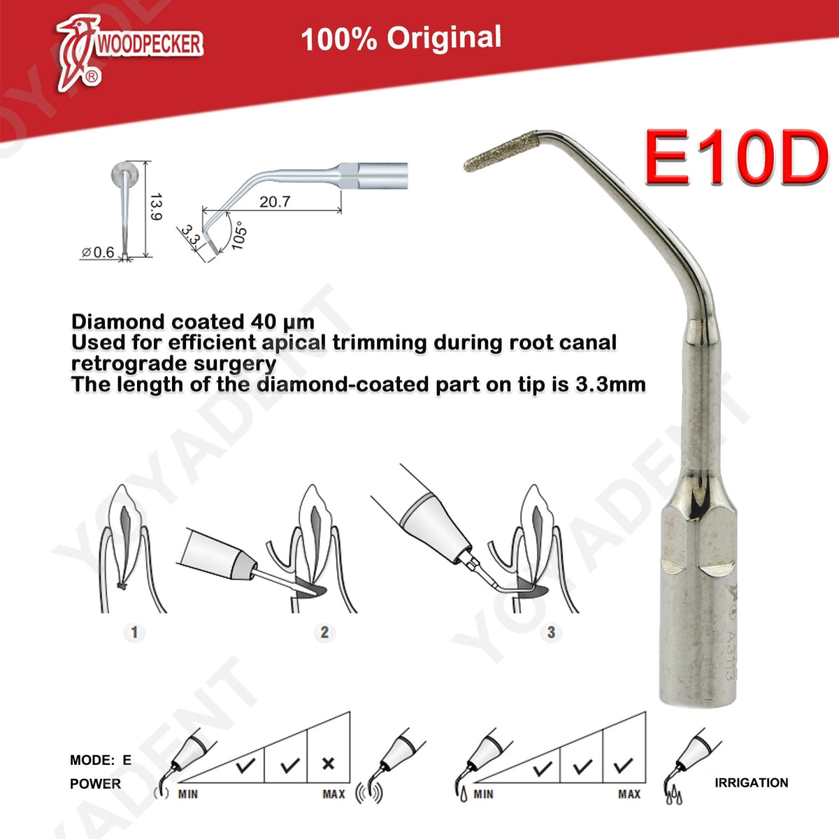 Woodpecker DTE Ultrasonic Scaler Tips
