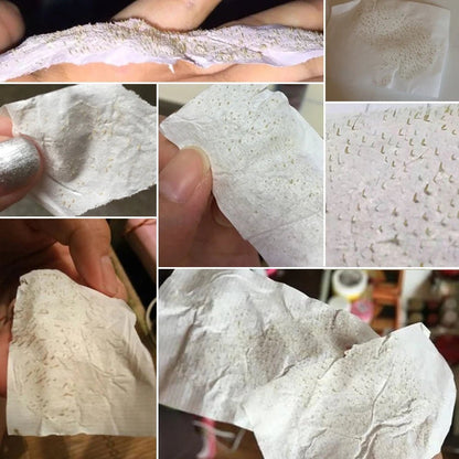 Personal Health Care Acne Treatment Face Mask