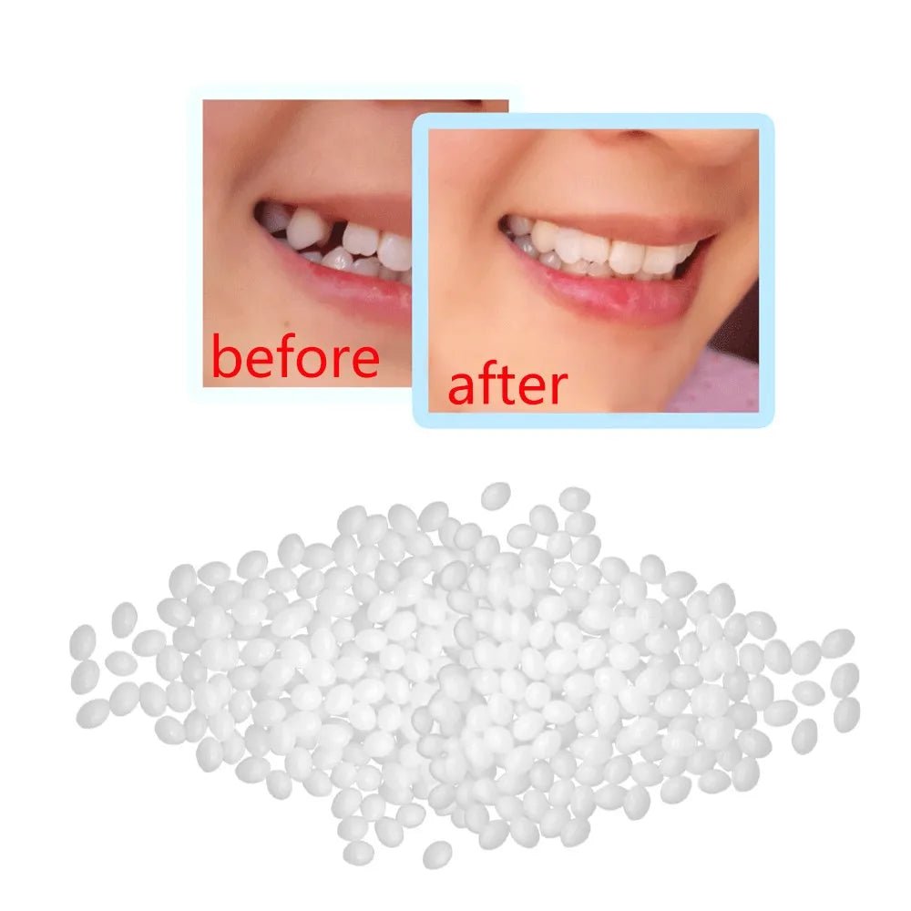 Dentistry Supplies & Equipment Temporary Tooth Repair Kit (15g/25g) Picture show a woman mouth and teeth before and after use of the product, very nice job